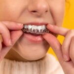 Crafting Your Best Look: Aesthetic Benefits of Invisalign